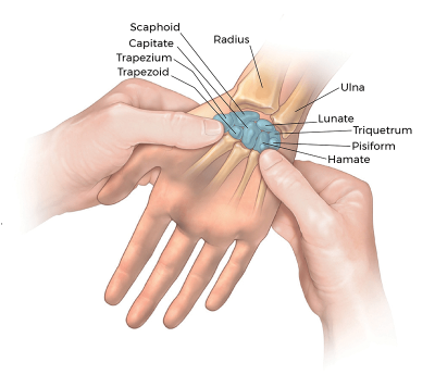 a palm facing up with labels showing the bones of the wrist and hand.