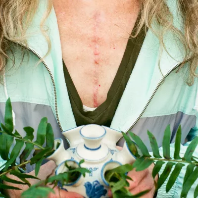 A woman with a scar on her chest holds a plant.