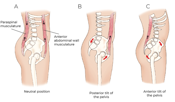 3 sketches of trunk flexors and extensors at the lumbosacral area.