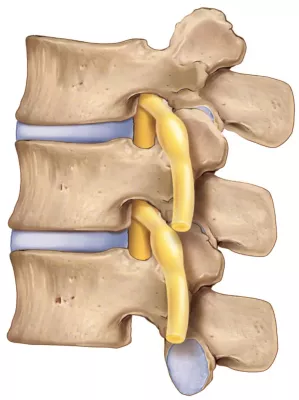 Illustration of an intervertebral foramen.