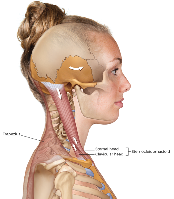 Lateral view of the sternocleidomastoid muscle in the neck region. 