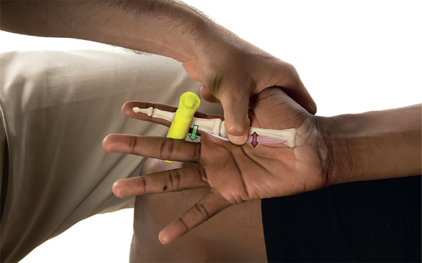 A client's hand holds a yellow highlighter between the first finger and the middle finger with the bone and muscles of the first finger superimposed for demonstration of its movement.