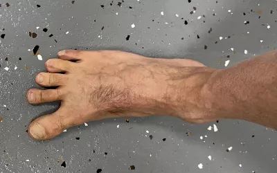 A person points their big toe inward.