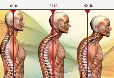 skeletal examples of weight of a human head and the pressure it puts on the spine