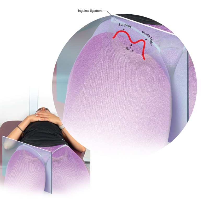 Sartorius and psoas major with the iliacus between.