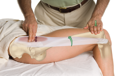 Palpation of the tensor fasciae latae. 