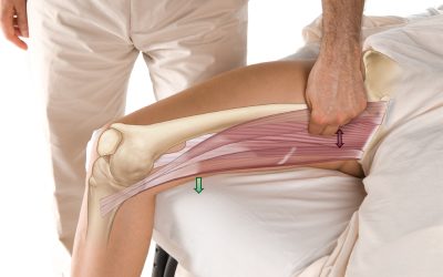 Palpation of the adductor magnus.