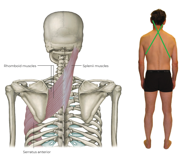 Diagrams of a skeleton (left) and a human (right) displaying the Spiral Line across the upper back.