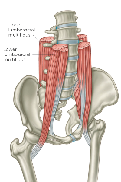 Illustration of the psoas in front and multifidus complex in back.