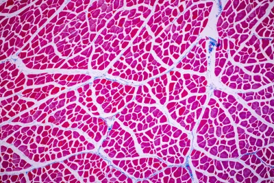 Mircroview of muscle tissue.