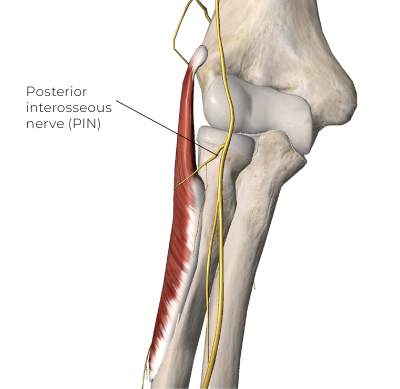 Proximity of the PIN to the edge of the supinator at the arcade of Frohse