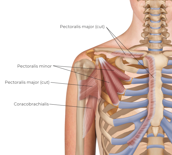 Illustration showing the pectoralis minor.