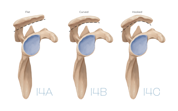 Images showing varying shapes of the acromion process.