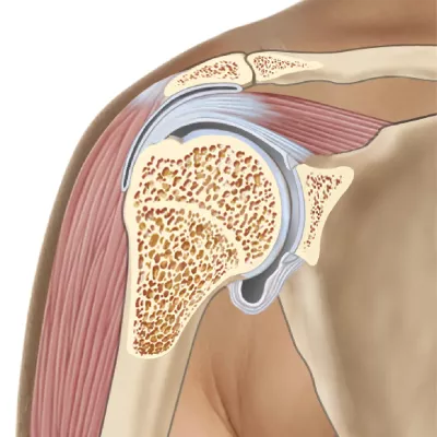 A frontal-plane cut through the right shoulder joint.