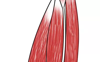 Quadriceps muscle group.