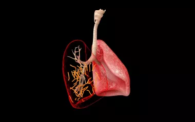 Two pink lungs, one with lines indicating scar tissue deposits. 