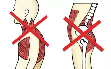 an "x" at the upper body and an "x" at the lower back demonstrating a criss-cross syndrome.