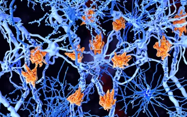 A spidery web of nerves within a cell.