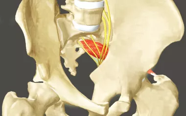Sciatic nerve on a pelvic anatomical diagram.