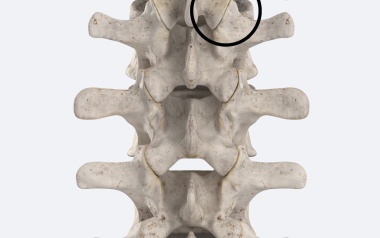 The z joint in the lumbar region accounts for low back pain.