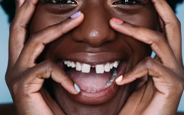 Black woman with wide smile holding her face with her hands. 