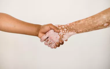 Two outstretched arms shake hands.