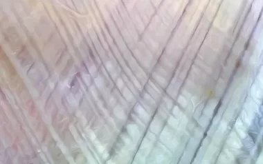 A magnified image of thoracolumbar fascia of the low back.