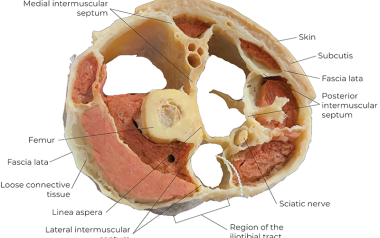 Cross-section of a human thigh. 