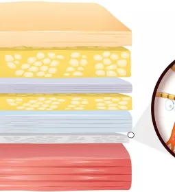 Illustration depicting the layers of epidermis.