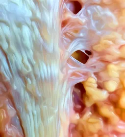 Close-up look at collagen fibers of the plantar fascia in the foot.