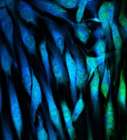 Fibroblasts seen through a microscope.