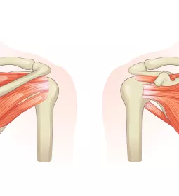 posterior and anterior view of the rotator cuff and shoulder muscles.