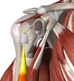 Anatomical display of the biceps tendon attached to the scapula.
