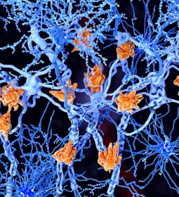 A spidery web of nerves within a cell.