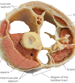 Cross-section of a human thigh. 
