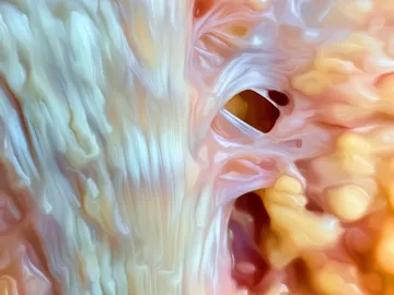 Close-up look at collagen fibers of the plantar fascia in the foot.