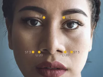 A close-up of a women's face with acupoints to drain sinuses highlighted.