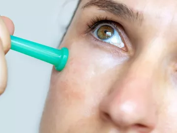 Close up of a women's cheek with a small cupping tool in place.