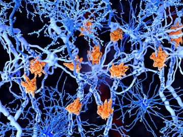 A spidery web of nerves within a cell.