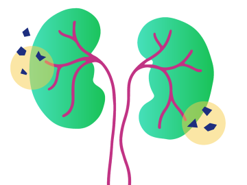 Cartoon illustration of two human kidneys.