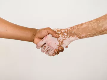 Two outstretched arms shake hands.