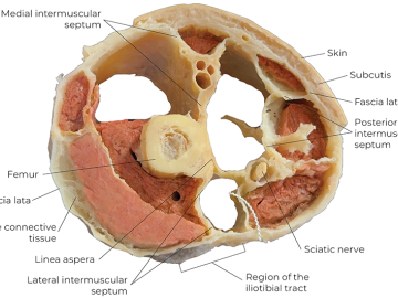 Cross-section of a human thigh. 