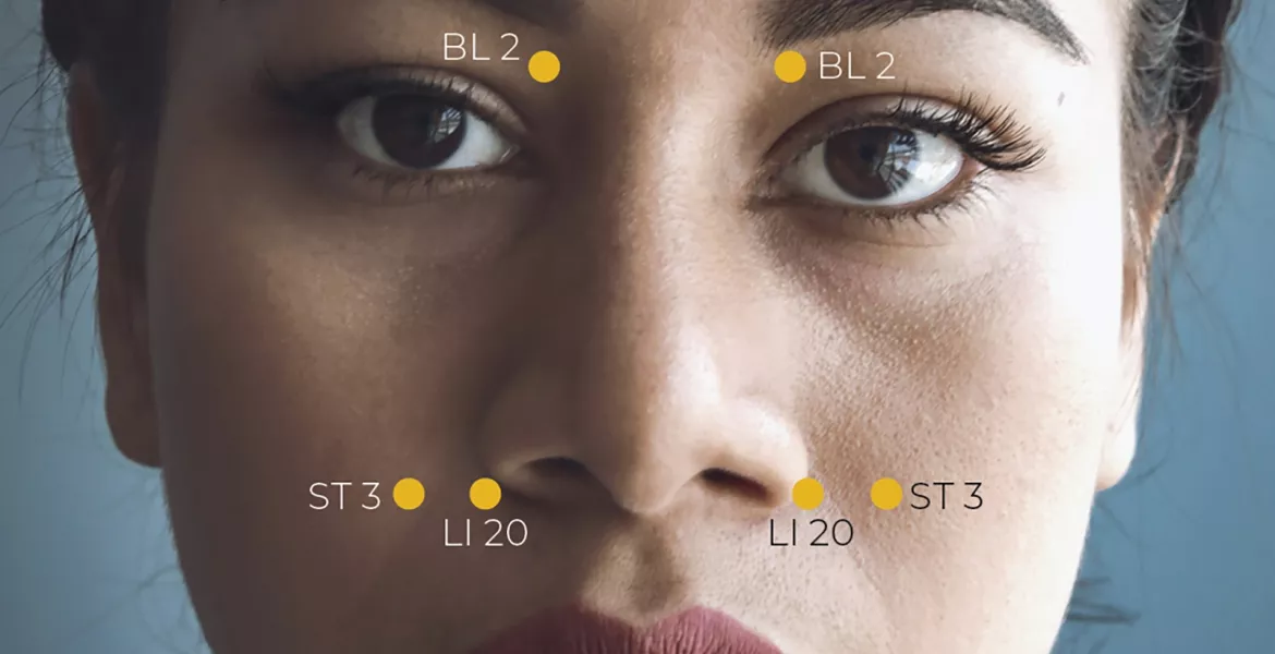 A close-up of a women's face with acupoints to drain sinuses highlighted.